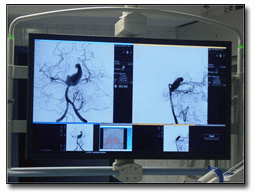 Ankara Hacettepe Medical Center interventional neuroradiology facility