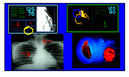 Annotator Option for QuadView HDx MultiViewer